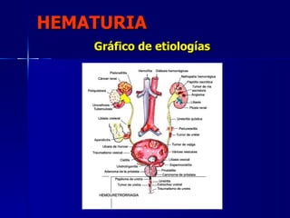 Urgencias urologicas (completo) clase Nº19 Slide 3