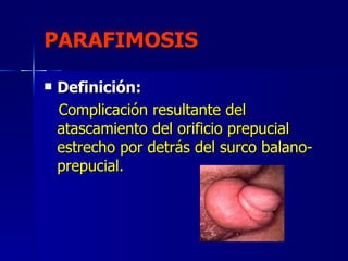 Urgencias urologicas (completo) clase Nº19 Slide 61