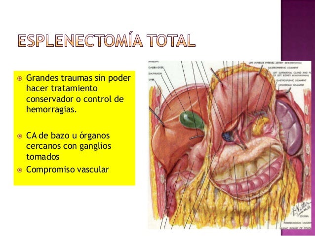 Urgencias urologicas y esplecnetomia
