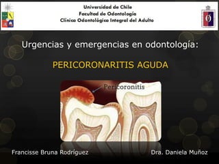 Urgencias y emergencias en odontología:
PERICORONARITIS AGUDA
Francisse Bruna Rodríguez Dra. Daniela Muñoz
 