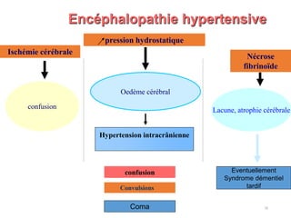 Ischémie cérébrale
Nécrose
fibrinoïde
confusion
Oedème cérébral
Lacune, atrophie cérébrale
Encéphalopathie hypertensive
pression hydrostatique
Eventuellement
Syndrome démentiel
tardif
Hypertension intracrânienne
Convulsions
confusion
Coma 16
 