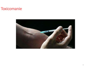 52
Toxicomanie
 
