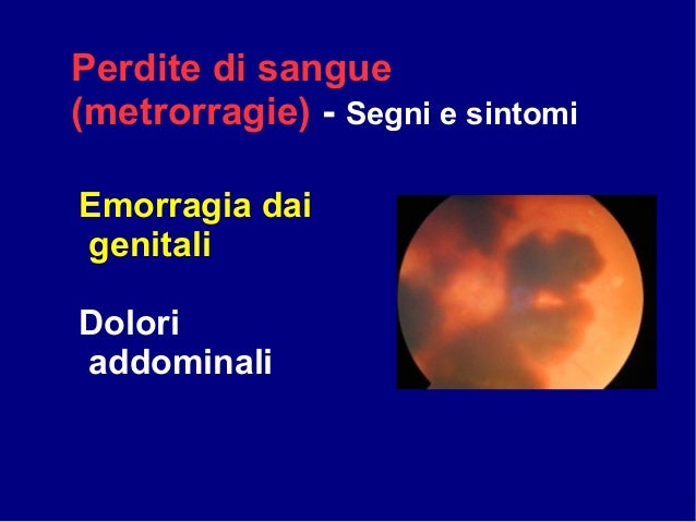 Emorroidi affilate geparinovy unguento
