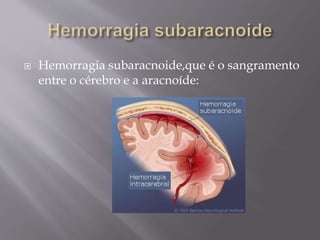  Hemorragia subaracnoide,que é o sangramento
entre o cérebro e a aracnoíde:
 
