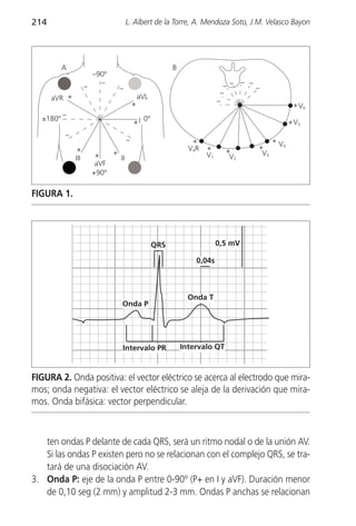 214                                     L. Albert de la Torre, A. Mendoza Soto, J.M. Velasco Bayon




          A                                                 B
                        –90º
                    –
                          –
                                   –                                           – – – ––
                                                                              –
      aVR +                                     aVL
                                                                             –
                                            +                                                       + V6
          –
  ±180º                                     + I 0º                                                 + V5
          –
                                        –                          +                        +V
               +                                                  V4R   +             +        4
                               +                                               +       V3
              III        +         II                                   V1      V2
                         aVF
                        +90º

FIGURA 1.




                                                      QRS                    0,5 mV

                                                                    0,04s



                                                                  Onda T
                                   Onda P




                                   Intervalo PR                 Intervalo QT



FIGURA 2. Onda positiva: el vector eléctrico se acerca al electrodo que mira-
mos; onda negativa: el vector eléctrico se aleja de la derivación que mira-
mos. Onda bifásica: vector perpendicular.



   ten ondas P delante de cada QRS, será un ritmo nodal o de la unión AV.
   Si las ondas P existen pero no se relacionan con el complejo QRS, se tra-
   tará de una disociación AV.
3. Onda P: eje de la onda P entre 0-90º (P+ en I y aVF). Duración menor
   de 0,10 seg (2 mm) y amplitud 2-3 mm. Ondas P anchas se relacionan
 