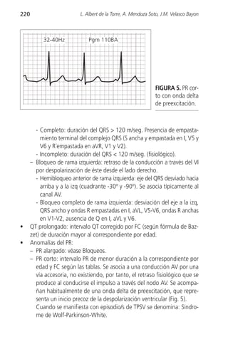 220                        L. Albert de la Torre, A. Mendoza Soto, J.M. Velasco Bayon



           32-40Hz             Pgm 110BA




                                                               FIGURA 5. PR cor-
                                                               to con onda delta
                                                               de preexcitación.



        - Completo: duración del QRS > 120 m/seg. Presencia de empasta-
           miento terminal del complejo QRS (S ancha y empastada en I, V5 y
           V6 y R´empastada en aVR, V1 y V2).
        - Incompleto: duración del QRS < 120 m/seg. (fisiológico).
      – Bloqueo de rama izquierda: retraso de la conducción a través del VI
        por despolarización de éste desde el lado derecho.
        - Hemibloqueo anterior de rama izquierda: eje del QRS desviado hacia
           arriba y a la izq (cuadrante -30º y -90º). Se asocia típicamente al
           canal AV.
        - Bloqueo completo de rama izquierda: desviación del eje a la izq,
           QRS ancho y ondas R empastadas en I, aVL, V5-V6, ondas R anchas
           en V1-V2, ausencia de Q en I, aVL y V6.
•     QT prolongado: intervalo QT corregido por FC (según fórmula de Baz-
      zet) de duración mayor al correspondiente por edad.
•     Anomalías del PR:
      – PR alargado: véase Bloqueos.
      – PR corto: intervalo PR de menor duración a la correspondiente por
        edad y FC según las tablas. Se asocia a una conducción AV por una
        vía accesoria, no existiendo, por tanto, el retraso fisiológico que se
        produce al conducirse el impulso a través del nodo AV. Se acompa-
        ñan habitualmente de una onda delta de preexcitación, que repre-
        senta un inicio precoz de la despolarización ventricular (Fig. 5).
        Cuando se manifiesta con episodio/s de TPSV se denomina: Síndro-
        me de Wolf-Parkinson-White.
 