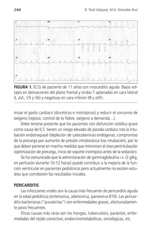 244                                         B. Toral Vázquez, M.A. Granados Ruiz




FIGURA 1. ECG de paciente de 11 años con miocarditis aguda. Bajos vol-
tajes en derivaciones del plano frontal y ondas T aplanadas en cara lateral
(I, aVL, V5 y V6) y negativas en cara inferior (III y aVF).


mizar el gasto cardiaco (diuréticos e inotrópicos) y reducir el consumo de
oxígeno (reposo, control de la fiebre, oxígeno a demanda…).
    Debe tenerse presente que los pacientes con disfunción sistólica grave
como causa de ICC tienen un riesgo elevado de parada cardiaca tras la intu-
bación endotraqueal (depleción de catecolaminas endógenas, compromiso
de la precarga por aumento de presión intratorácica tras intubación), por lo
que deben ponerse en marcha medidas que minimicen el rieso periintubación
(optimización de precarga, inicio de soporte inotrópico antes de la sedación).
    Se ha comunicado que la administración de gammaglobulina i.v. (2 g/kg,
en perfusión durante 10-12 horas) puede contribuir a la mejoría de la fun-
ción ventricular en pacientes pediátricos pero actualmente no existen estu-
dios que corroboren los resultados iniciales.

PERICARDITIS
     Las infecciones virales son la causa más frecuente de pericarditis aguda
en la edad pediátrica (enterovirus, adenovirus, parvovirus B19). Las pericar-
ditis bacterianas (“purulentas”) son enfermedades graves, afortunadamen-
te poco frecuentes.
     Otras causas más raras son los hongos, tuberculosis, parásitos, enfer-
medades del tejido conectivo, endocrinometabólicas, oncológicas, etc.
 