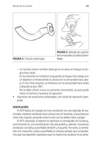 Manejo de la vía aérea                                                      29




                                             FIGURA 3. Método de sujeción
                                             de la mascarilla y la bolsa autoin-
FIGURA 2. Cánula orofaríngea.                flable.


    – Un tamaño menor también obstruye la vía aérea al empujar la len-
       gua hacia atrás.
       En los lactantes se introduce empujando la lengua hacia abajo con
       un depresor e introduciendo la cánula con la concavidad hacia aba-
       jo. En los niños mayores, se introduce con la concavidad hacia arriba
       y después se gira 180º.
       No se debe utilizar nunca en pacientes conscientes, ya que puede
       inducir el vómito y favorecer la aspiración.
•   Aspiración de secreciones orofaríngeas, con sonda de aspiración apro-
    piada.

VENTILACIÓN
    En RCP básica (sin equipo) se inicia ventilación con aire espirado de rea-
nimador, mediante ventilación boca a boca-nariz en lactantes, o boca-boca en
niños más mayores, pinzando antes la nariz con los dedos índice y pulgar.
    En RCP avanzada, el objetivo es optimizar lo conseguido con la básica,
suministrando O2 a la concentración más alta posible y, además, iniciaremos
ventilación con bolsa autoinflable (Ambú®) y mascarilla. Por tanto, la ventila-
ción con mascarilla y bolsa autoinflable se utilizará siempre que comprobe-
mos que hay depresión respiratoria que no mejora tras recolocar la vía aérea.
 