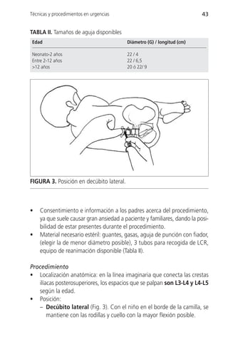 Técnicas y procedimientos en urgencias                                    43


TABLA II. Tamaños de aguja disponibles
 Edad                                     Diámetro (G) / longitud (cm)

 Neonato-2 años                           22 / 4
 Entre 2-12 años                          22 / 6,5
 >12 años                                 20 ó 22/ 9




FIGURA 3. Posición en decúbito lateral.



•   Consentimiento e información a los padres acerca del procedimiento,
    ya que suele causar gran ansiedad a paciente y familiares, dando la posi-
    bilidad de estar presentes durante el procedimiento.
•   Material necesario estéril: guantes, gasas, aguja de punción con fiador,
    (elegir la de menor diámetro posible), 3 tubos para recogida de LCR,
    equipo de reanimación disponible (Tabla II).

Procedimiento
• Localización anatómica: en la línea imaginaria que conecta las crestas
   ilíacas posterosuperiores, los espacios que se palpan son L3-L4 y L4-L5
   según la edad.
• Posición:
   – Decúbito lateral (Fig. 3). Con el niño en el borde de la camilla, se
       mantiene con las rodillas y cuello con la mayor flexión posible.
 