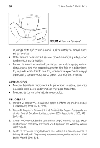 46                                                    S. Mesa García, C. Carpio García




                                             FIGURA 4. Postura “en rana”.


     la jeringa hasta que refluye la orina. Se debe obtener al menos mues-
     tra para cultivo.
•    Ocluir la salida de la uretra durante el procedimiento ya que la punción
     también estimula la micción.
•    En caso de no obtener aspirado, retirar parcialmente la aguja y redirec-
     cionar, en este caso más perpendicularmente. Si se falla en el primer inten-
     to, se puede repetir tras 30 minutos, esperando la repleción de la vejiga
     o proceder a sondaje vesical. No se deben hacer más de 3 intentos.

Complicaciones
• Mayores: hematuria macroscópica. La perforación intestinal, peritonitis
   o absceso de la pared abdominal son muy poco frecuentes.
• Menores: es común la hematuria microscópica.

BIBLIOGRAFÍA
1.   Stovroff M, Teague WG. Intravenous access in infants and children. Pediatr
     Clin North Am. 1998; 46: 1373-93.
2.   Biarent D, Bingham R, Richmond S, et al. Paediatric Life Support European Resus-
     citation Council Guidelines for Resuscitation 2005. Resuscitation. 2005; 67S1:
     S97-S133.
3.   Cronan KM, Wiley II JF. Lumbar puncture. En King C, Henretig FM, eds. Textbo-
     ok of pediatrics emergency procedures. 2ª ed. Lippincott and Williams y Wilkins,
     2007: 505-14.
4.   Benito FJ. Técnicas de recogida de orina en el lactante. En: Benito Fernández FJ,
     Mintegui Raso S, eds. Diagnóstico y tratamiento de urgencias pediátricas. 3ª ed.
     Ergon. Madrid, 2002; 53-8.
 