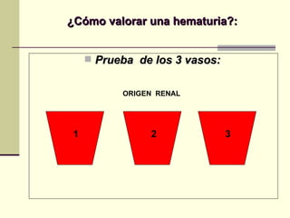 ¿Cómo valorar una hematuria?: Prueba  de los 3 vasos: ORIGEN  RENAL 1 2 3 