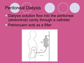 Peritoneal Dialysis Dialysis solution flow into the peritoneal (abdominal) cavity through a catheter Petrionuem acts as a filter 