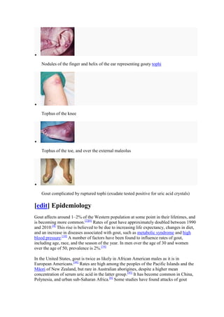Uric acid | DOCX