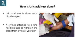 How is Uric acid test done?
• Uric acid test is done on a
blood sample
• A syringe attached to a fine
needle is used to withdraw the
blood from a vein of your arm
 
