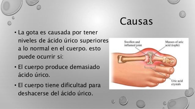 que es el acido urico y porque da que es el acido urico y porque da