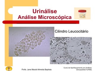 Curso de Aperfeiçoamento em Análises
Clínicas/DACT/UFMGProfa. Jane Maciel Almeida Baptista
Urinálise
Análise Microscópica
Cilindro Leucocitário
 