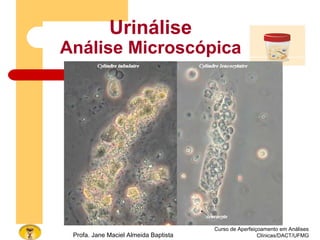 Curso de Aperfeiçoamento em Análises
Clínicas/DACT/UFMGProfa. Jane Maciel Almeida Baptista
Urinálise
Análise Microscópica
 