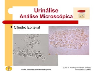 Curso de Aperfeiçoamento em Análises
Clínicas/DACT/UFMGProfa. Jane Maciel Almeida Baptista
 Cilindro Epitelial
Urinálise
Análise Microscópica
 