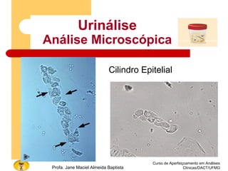 Curso de Aperfeiçoamento em Análises
Clínicas/DACT/UFMGProfa. Jane Maciel Almeida Baptista
Urinálise
Análise Microscópica
Cilindro Epitelial
 