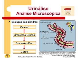 Curso de Aperfeiçoamento em Análises
Clínicas/DACT/UFMGProfa. Jane Maciel Almeida Baptista
 Evolução dos cilindros
Urinálise
Análise Microscópica
Celular
Granuloso Grosso
Granuloso Fino
Céreo
 