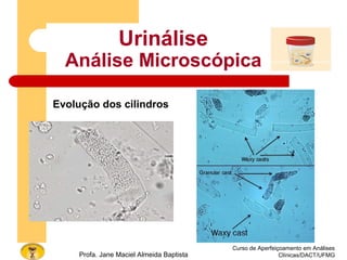 Curso de Aperfeiçoamento em Análises
Clínicas/DACT/UFMGProfa. Jane Maciel Almeida Baptista
Urinálise
Análise Microscópica
Evolução dos cilindros
 
