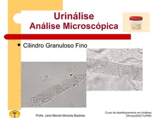 Curso de Aperfeiçoamento em Análises
Clínicas/DACT/UFMGProfa. Jane Maciel Almeida Baptista
Urinálise
Análise Microscópica
 Cilindro Granuloso Fino
 