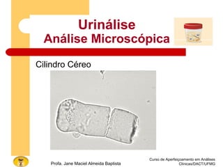 Curso de Aperfeiçoamento em Análises
Clínicas/DACT/UFMGProfa. Jane Maciel Almeida Baptista
Urinálise
Análise Microscópica
Cilindro Céreo
 