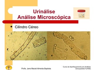 Urinálise
Análise Microscópica
 Cilindro Céreo
Curso de Aperfeiçoamento em Análises
Clínicas/DACT/UFMGProfa. Jane Maciel Almeida Baptista
 