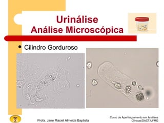 Curso de Aperfeiçoamento em Análises
Clínicas/DACT/UFMGProfa. Jane Maciel Almeida Baptista
 Cilindro Gorduroso
Urinálise
Análise Microscópica
 