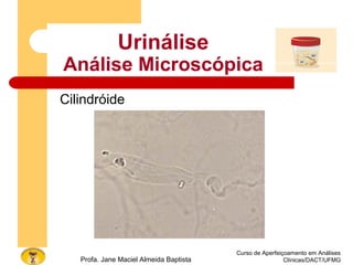 Curso de Aperfeiçoamento em Análises
Clínicas/DACT/UFMGProfa. Jane Maciel Almeida Baptista
Urinálise
Análise Microscópica
Cilindróide
 