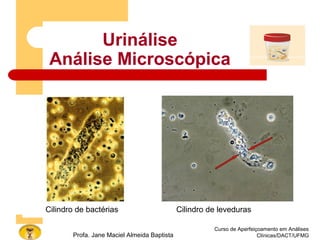 Urinálise
Análise Microscópica
Curso de Aperfeiçoamento em Análises
Clínicas/DACT/UFMGProfa. Jane Maciel Almeida Baptista
Cilindro de bactérias Cilindro de leveduras
 