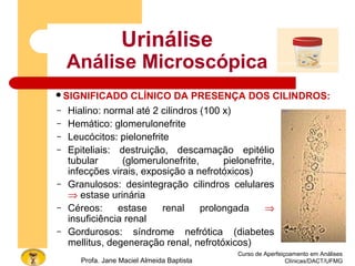 Curso de Aperfeiçoamento em Análises
Clínicas/DACT/UFMGProfa. Jane Maciel Almeida Baptista
Urinálise
Análise Microscópica
– Hialino: normal até 2 cilindros (100 x)
– Hemático: glomerulonefrite
– Leucócitos: pielonefrite
– Epiteliais: destruição, descamação epitélio
tubular (glomerulonefrite, pielonefrite,
infecções virais, exposição a nefrotóxicos)
– Granulosos: desintegração cilindros celulares
⇒ estase urinária
– Céreos: estase renal prolongada ⇒
insuficiência renal
– Gordurosos: síndrome nefrótica (diabetes
mellitus, degeneração renal, nefrotóxicos)
SIGNIFICADO CLÍNICO DA PRESENÇA DOS CILINDROS:
 