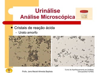 Curso de Aperfeiçoamento em Análises
Clínicas/DACT/UFMGProfa. Jane Maciel Almeida Baptista
 Cristais de reação ácida
– Urato amorfo
Urinálise
Análise Microscópica
 