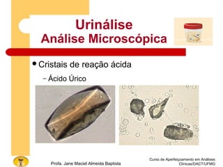 Curso de Aperfeiçoamento em Análises
Clínicas/DACT/UFMGProfa. Jane Maciel Almeida Baptista
Urinálise
Análise Microscópica
Cristais de reação ácida
– Ácido Úrico
 