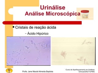 Curso de Aperfeiçoamento em Análises
Clínicas/DACT/UFMGProfa. Jane Maciel Almeida Baptista
Urinálise
Análise Microscópica
Cristais de reação ácida
– Ácido Hipúrico
 