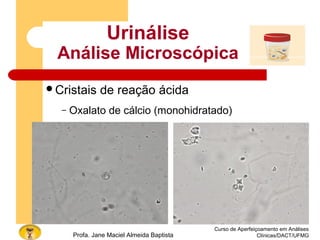 Curso de Aperfeiçoamento em Análises
Clínicas/DACT/UFMGProfa. Jane Maciel Almeida Baptista
Urinálise
Análise Microscópica
Cristais de reação ácida
– Oxalato de cálcio (monohidratado)
 