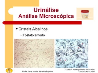 Curso de Aperfeiçoamento em Análises
Clínicas/DACT/UFMGProfa. Jane Maciel Almeida Baptista
Urinálise
Análise Microscópica
Cristais Alcalinos
– Fosfato amorfo
 