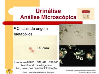 Curso de Aperfeiçoamento em Análises
Clínicas/DACT/UFMGProfa. Jane Maciel Almeida Baptista
Urinálise
Análise Microscópica
Cristais de origem
metabólica
Leucina
Leucinose (MSUD): EIM, AR, 1/290.000
↓α-cetoácido desidrogenase
Leu, Isoleu, Val na urina/ Intoxicação
 