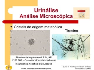 Curso de Aperfeiçoamento em Análises
Clínicas/DACT/UFMGProfa. Jane Maciel Almeida Baptista
 Cristais de origem metabólica
Urinálise
Análise Microscópica
Tirosina
Tirosinemia hepato-renal: EIM, AR
1/120.000, ↓Fumarilacetoacetato hidrolase
Insuficiência hepática e tubulopatia
 