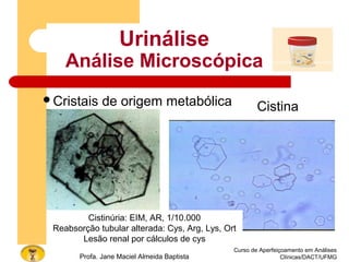 Curso de Aperfeiçoamento em Análises
Clínicas/DACT/UFMGProfa. Jane Maciel Almeida Baptista
Urinálise
Análise Microscópica
Cristais de origem metabólica Cistina
Cistinúria: EIM, AR, 1/10.000
Reabsorção tubular alterada: Cys, Arg, Lys, Ort
Lesão renal por cálculos de cys
 