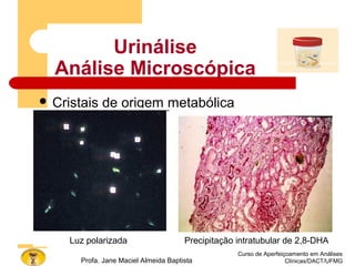 Urinálise
Análise Microscópica
 Cristais de origem metabólica
2,8-dihidroxiadenina (2,8-DHA)
Curso de Aperfeiçoamento em Análises
Clínicas/DACT/UFMGProfa. Jane Maciel Almeida Baptista
Luz polarizadaLuz polarizada Precipitação intratubular de 2,8-DHA
 