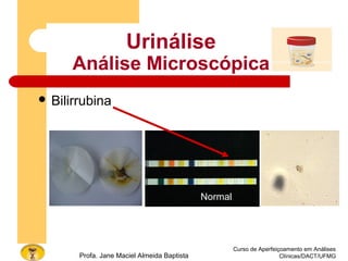 Curso de Aperfeiçoamento em Análises
Clínicas/DACT/UFMGProfa. Jane Maciel Almeida Baptista
Urinálise
Análise Microscópica
 Bilirrubina
Normal
 
