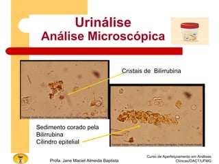Curso de Aperfeiçoamento em Análises
Clínicas/DACT/UFMGProfa. Jane Maciel Almeida Baptista
Urinálise
Análise Microscópica
Sedimento corado pela
Bilirrubina
Cilindro epitelial
Cristais de Bilirrubina
 