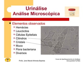 Curso de Aperfeiçoamento em Análises
Clínicas/DACT/UFMGProfa. Jane Maciel Almeida Baptista
Urinálise
Análise Microscópica
 Elementos observados
 Hemácias
 Leucócitos
 Células Epiteliais
 Cilindros
 Cristais
 Muco
 Flora bacteriana
 Diversos
 