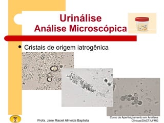 Curso de Aperfeiçoamento em Análises
Clínicas/DACT/UFMGProfa. Jane Maciel Almeida Baptista
 Cristais de origem iatrogênica
Urinálise
Análise Microscópica
 