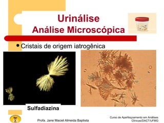 Curso de Aperfeiçoamento em Análises
Clínicas/DACT/UFMGProfa. Jane Maciel Almeida Baptista
Cristais de origem iatrogênica
Urinálise
Análise Microscópica
Sulfadiazina
 