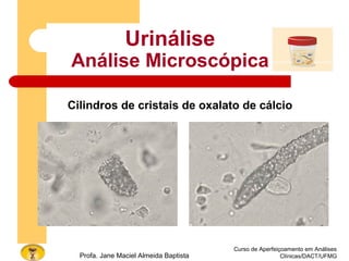 Curso de Aperfeiçoamento em Análises
Clínicas/DACT/UFMGProfa. Jane Maciel Almeida Baptista
Urinálise
Análise Microscópica
Cilindros de cristais de oxalato de cálcio
 