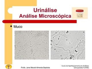 Curso de Aperfeiçoamento em Análises
Clínicas/DACT/UFMGProfa. Jane Maciel Almeida Baptista
 Muco
Urinálise
Análise Microscópica
 