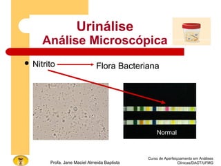 Curso de Aperfeiçoamento em Análises
Clínicas/DACT/UFMGProfa. Jane Maciel Almeida Baptista
Urinálise
Análise Microscópica
 Nitrito Flora Bacteriana
Normal
 