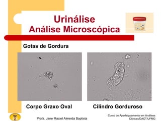 Curso de Aperfeiçoamento em Análises
Clínicas/DACT/UFMGProfa. Jane Maciel Almeida Baptista
Urinálise
Análise Microscópica
Gotas de Gordura
Corpo Graxo Oval Cilindro Gorduroso
 